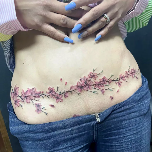 Cherry blossom tummy tuck tattoo