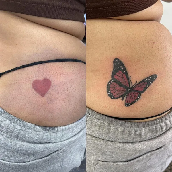 Butterfly Cover Up Tattoo 1