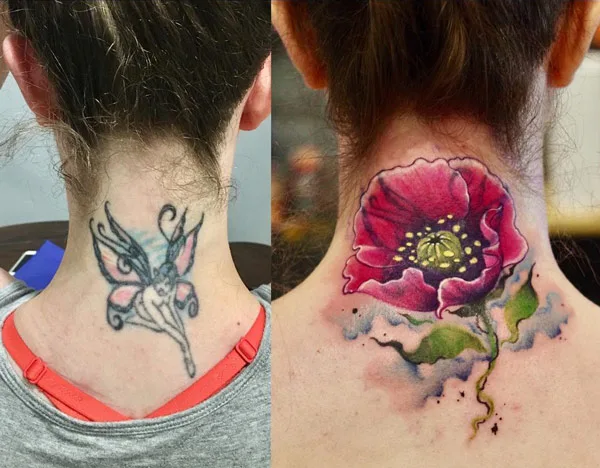 Cover Up Neck Tattoo 2
